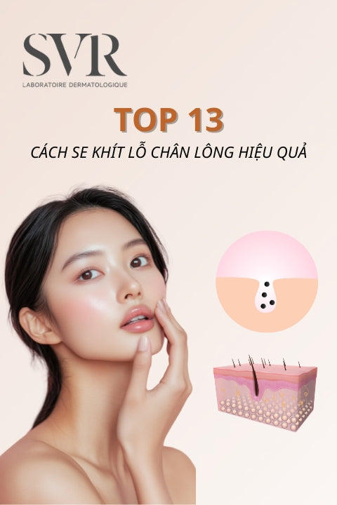 Top 13 cách se khít lỗ chân lông da mặt an toàn, hiệu quả