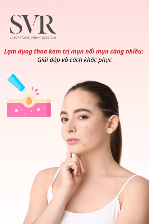 Lạm dụng thoa kem trị mụn nổi mụn càng nhiều: Giải đáp và cách khắc phục