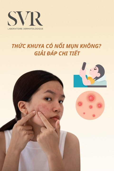 Thức khuya có nổi mụn không? Giải đáp chi tiết