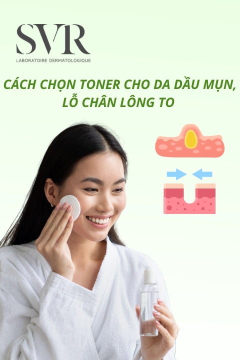TOP toner cho da dầu mụn, kiềm dầu, se khít lỗ chân lông to và cách chọn