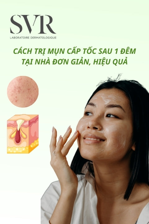 5+ cách trị mụn cấp tốc sau 1 đêm tại nhà đơn giản, hiệu quả