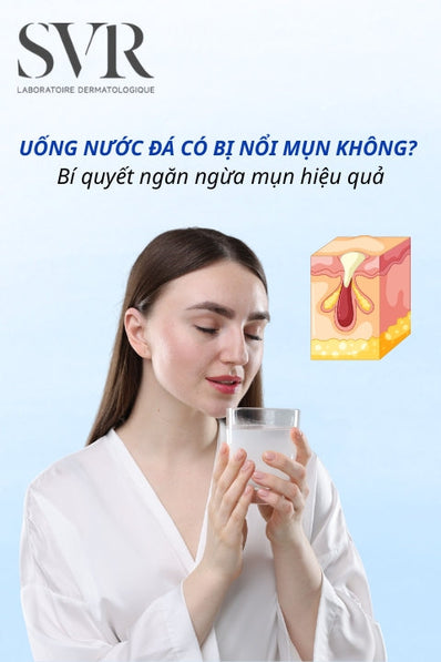 Uống nước đá có bị nổi mụn không? Bí quyết ngăn ngừa mụn hiệu quả