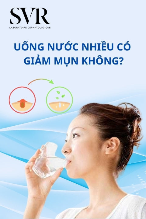 uống nhiều nước có giảm mụn không