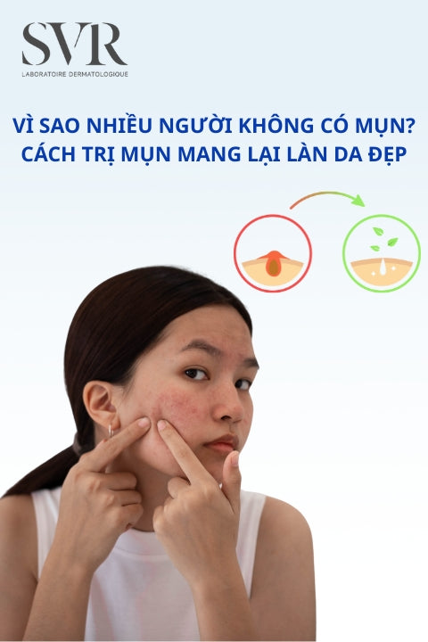 Vì sao nhiều người không có mụn? Cách trị mụn mang lại làn da đẹp