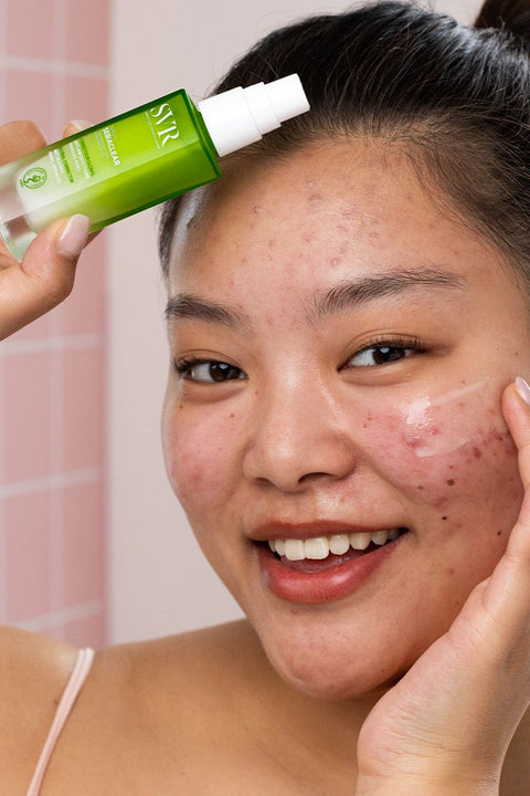 Tinh Chất Giảm Mụn, Mờ Thâm SVR Sebiaclear Serum 30ml
