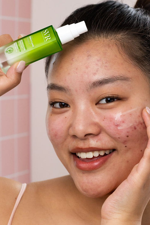 Tinh Chất Giảm Mụn, Mờ Thâm SVR Sebiaclear Serum 30ml