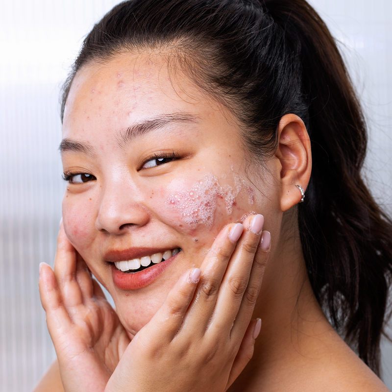 Gel Rửa Mặt Cho Da Dầu Mụn SVR Sebiaclear Gel Moussant