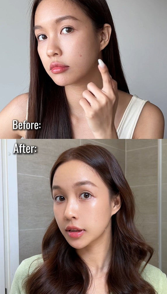 Cùng Lê Chi chia sẻ trải nghiệm bộ đôi giảm mụn SVR Sebiaclear